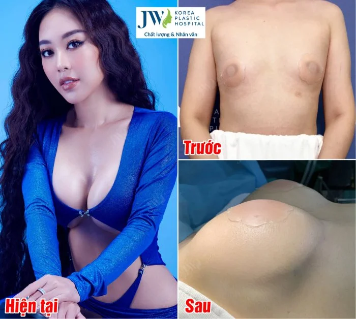 Ảnh minh hoạ ảnh sex vú to số 12